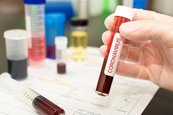 Thumbnail photo for Coronavirus – what should I do and what rights do my employees have?
